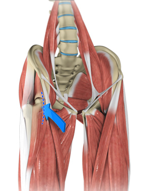 Direct Anterior Approach