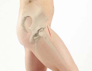 Anterior
                                    Total Hip Replacement