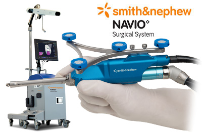 NAVIO Robotics-assisted Surgical System
